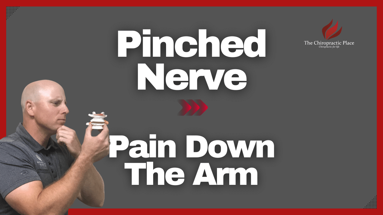 Pinched Nerve; Pain Down The Arm | The Chiropractic Place